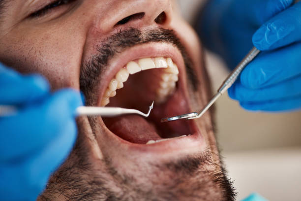 Best Knocked-Out Tooth Emergency  in Glenshaw, PA