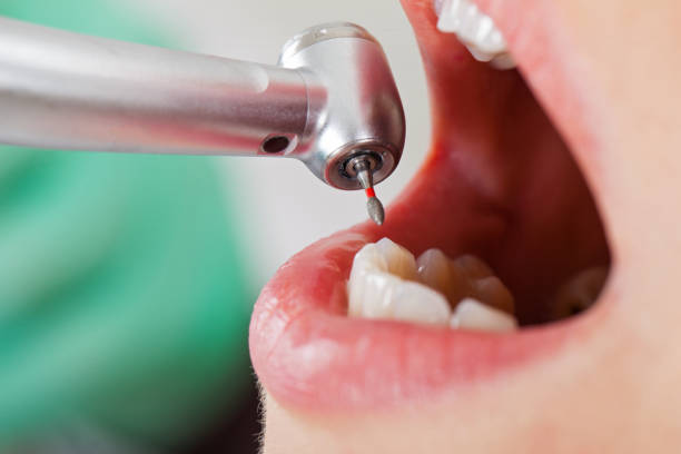 Best Emergency Tooth Extraction  in Glenshaw, PA